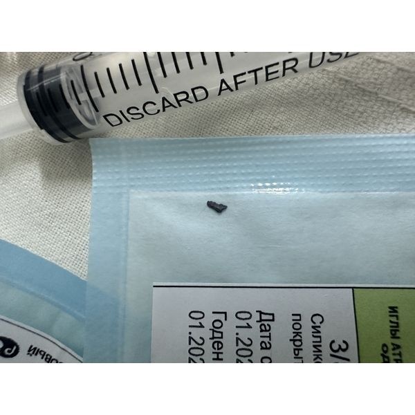 Удалённое инородное тело