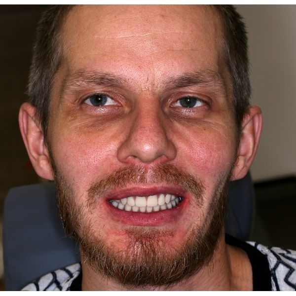 После лечения