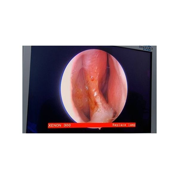 До операции