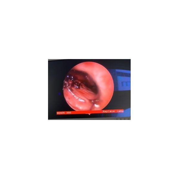 Сразу после операции