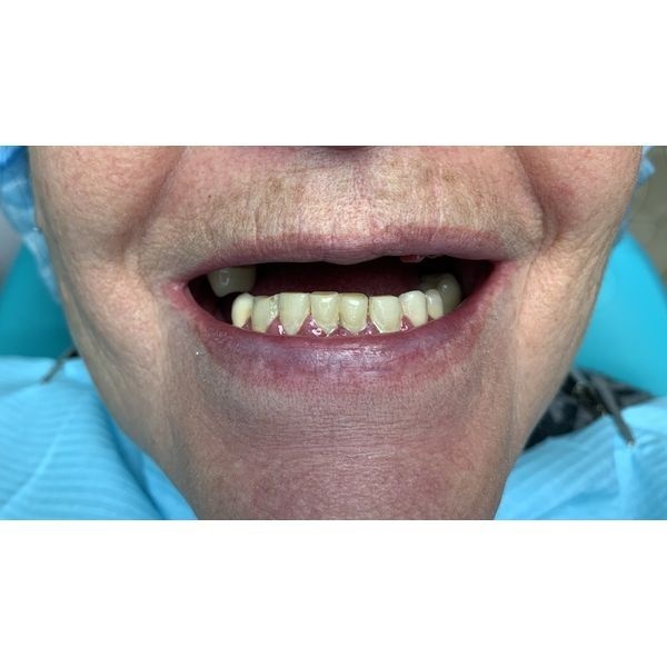 Ситуация до лечения