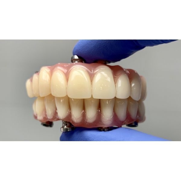 Съёмная конструкция