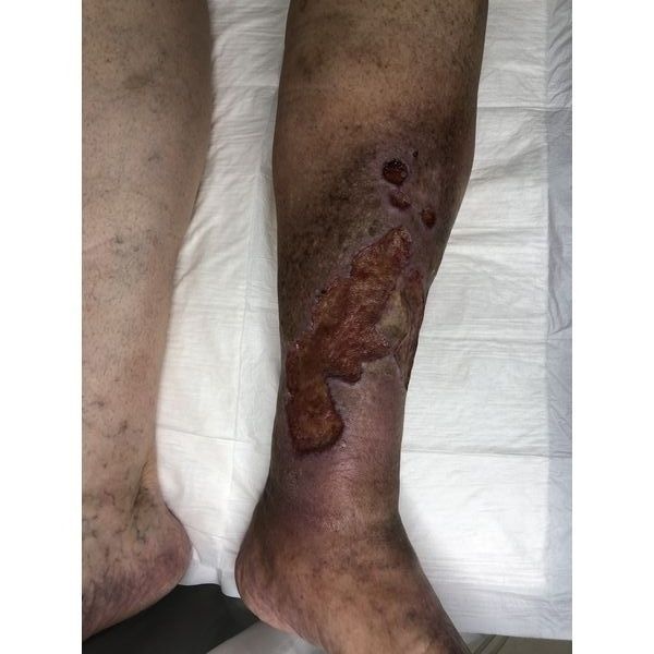 Перед началом лечения 