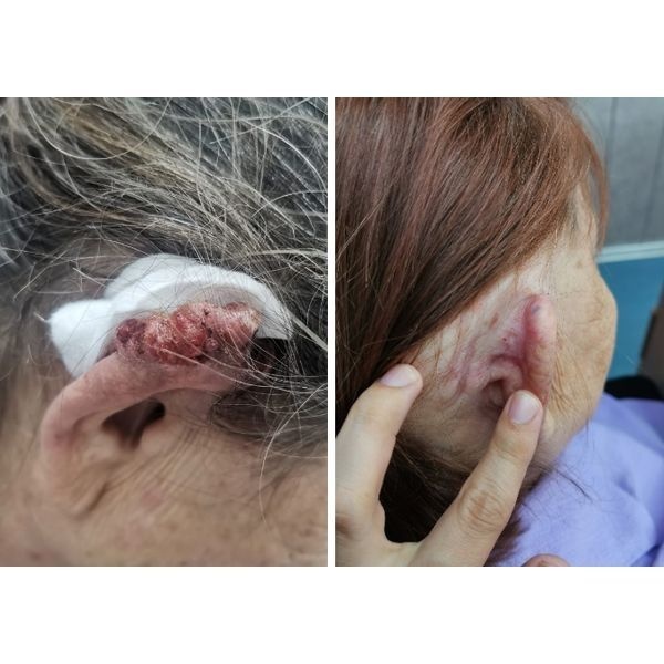 Ситуация до и после лечения Ситуация до и после лечения