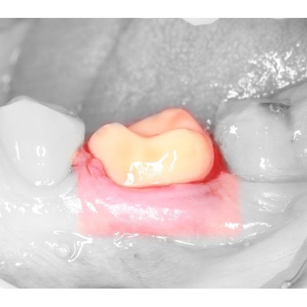 Повторная примерка