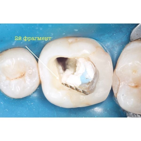 Второй фрагмент Второй фрагмент