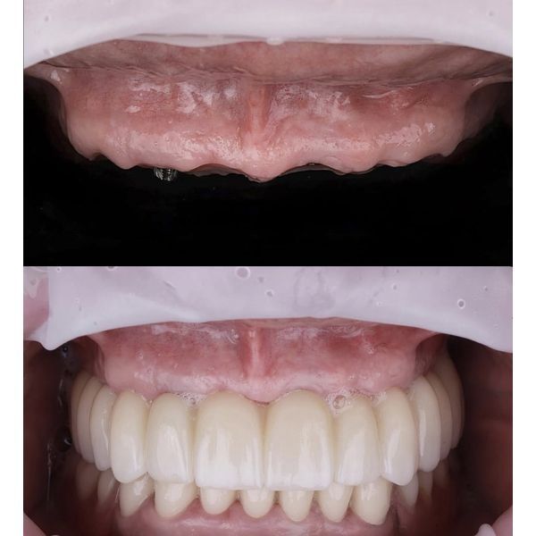 До и после лечения