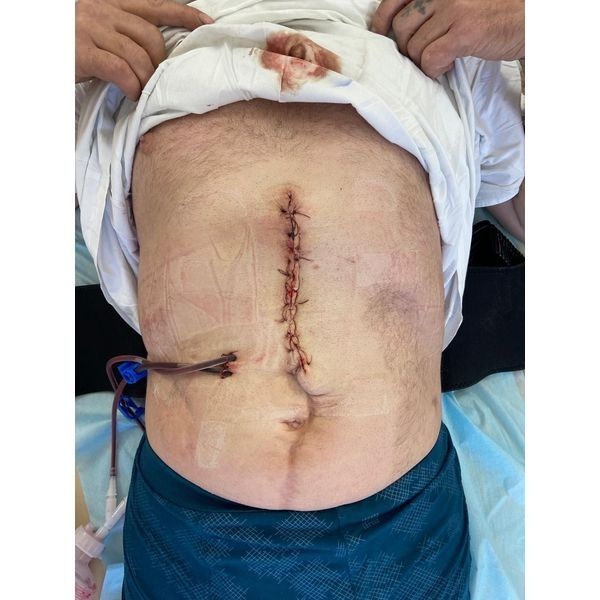 Состояние пациента на следующий день после операции