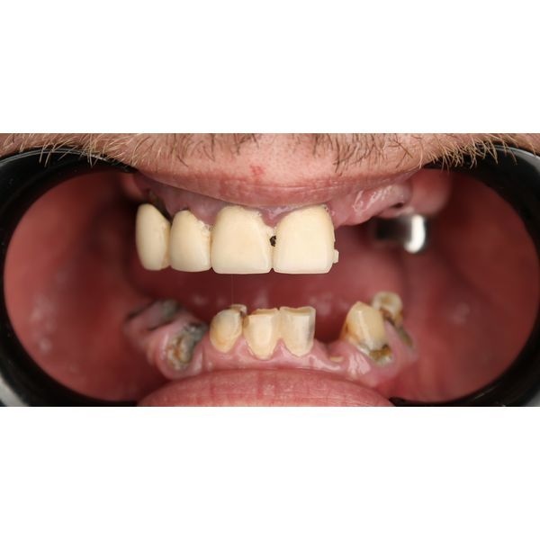 Ситуация до лечения