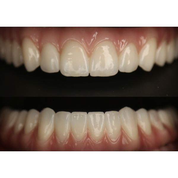 Результат лечения