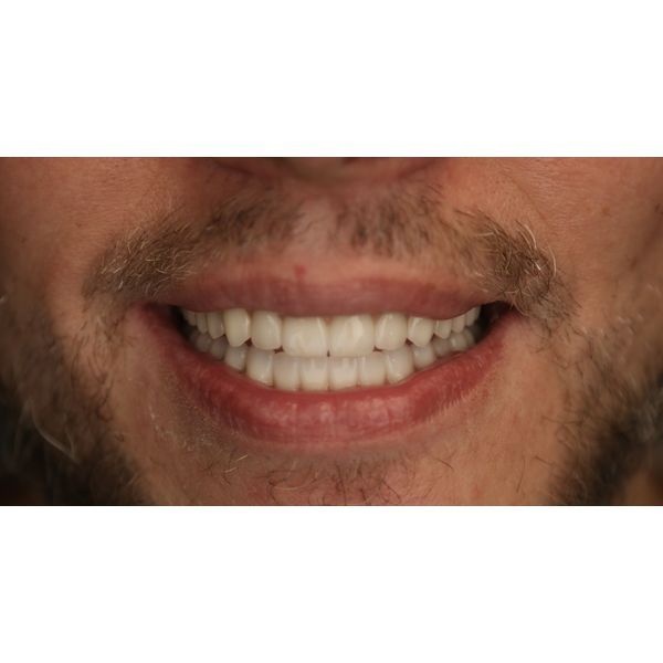 Результат лечения