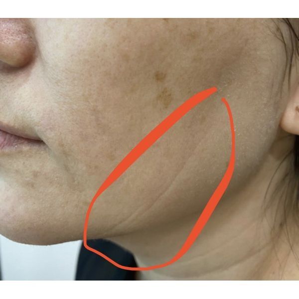 Кожа до лечения