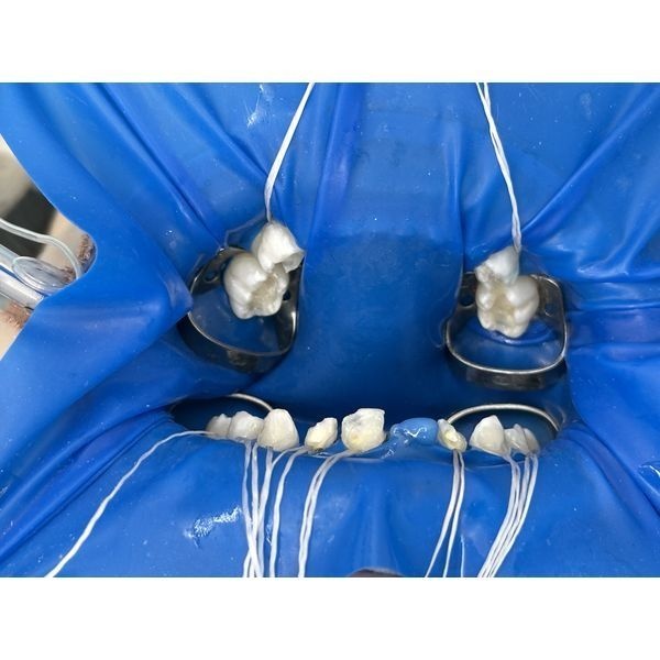 Процесс лечения