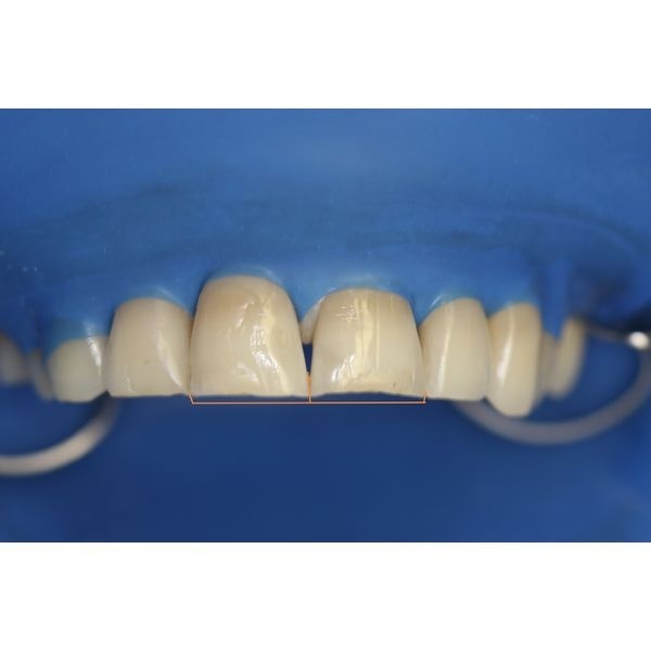 Ориентиры будущей реставрации