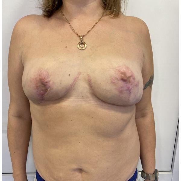 Динамика заживления