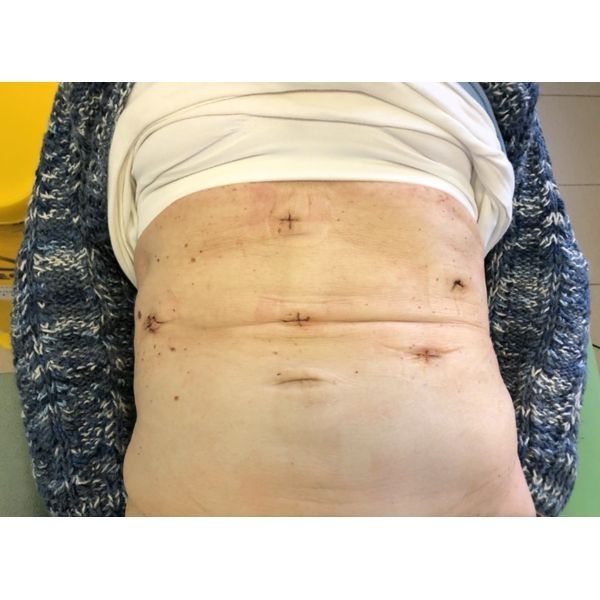 Внешний вид пациентки после операции