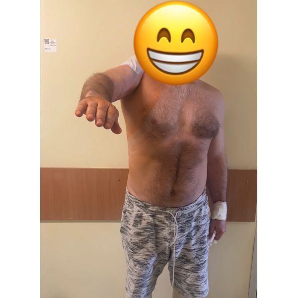 Объём движений после операции на 1-е сутки Объём движений после операции на 1-е сутки