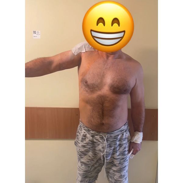 Объём движений после операции на 1-е сутки Объём движений после операции на 1-е сутки