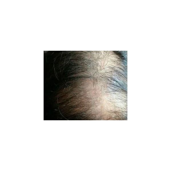 До лечения (декабрь 2024 года)