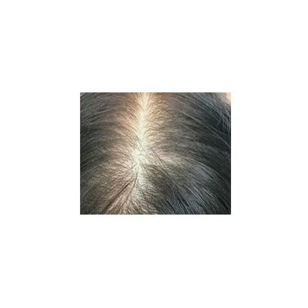 После лечения (май 2025 года)