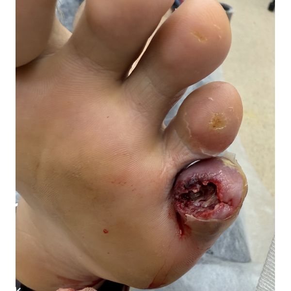 На осмотре в день поступления На осмотре в день поступления