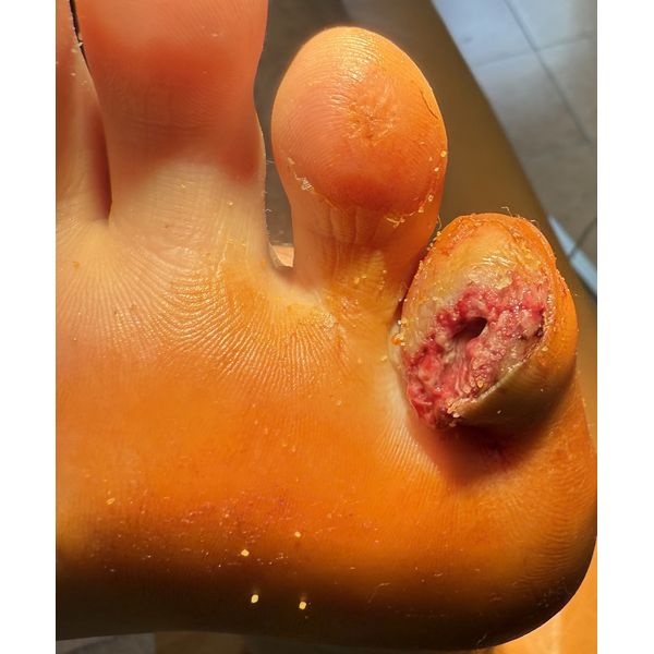 Через 3 дня после лечения Через 3 дня после лечения