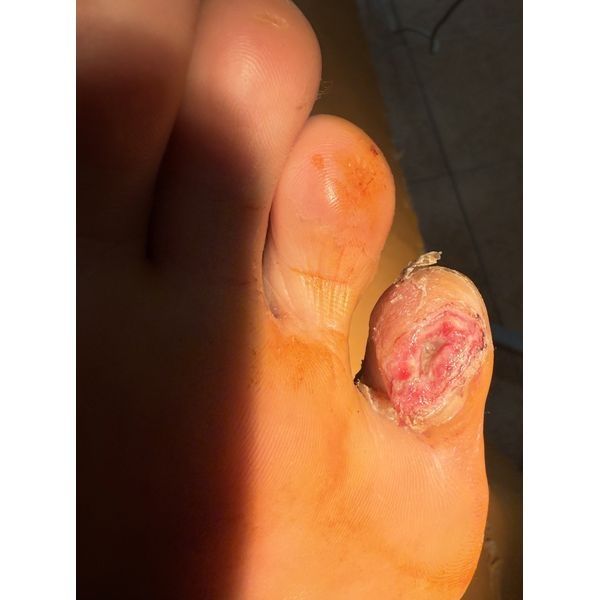 Через 5 дней после лечения Через 5 дней после лечения