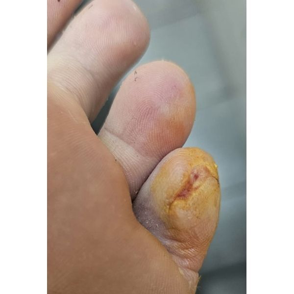 Через 14 дней после лечения Через 14 дней после лечения