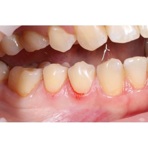 После лечения