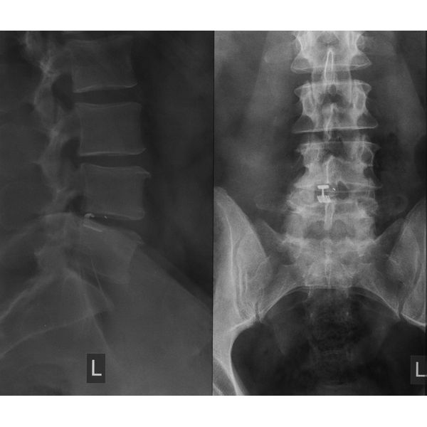 После лечения