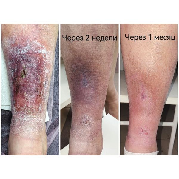 Динамика лечения