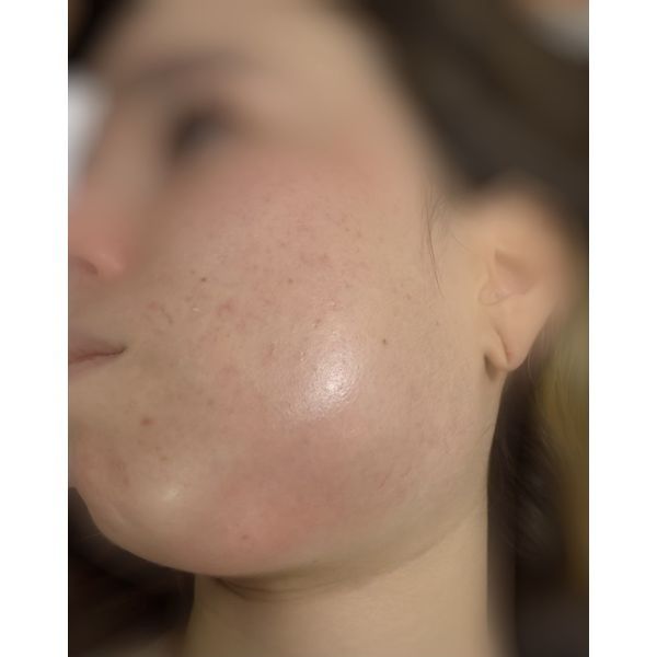 Пациентка при поступлении в больницу