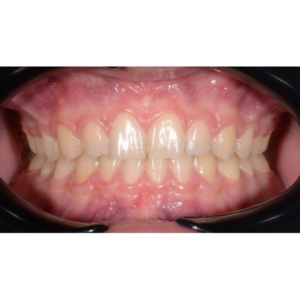 После лечения