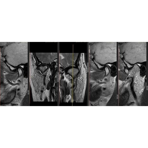 Снимок МРТ Снимок МРТ