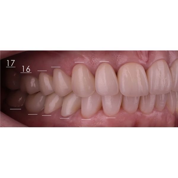 После лечения После лечения