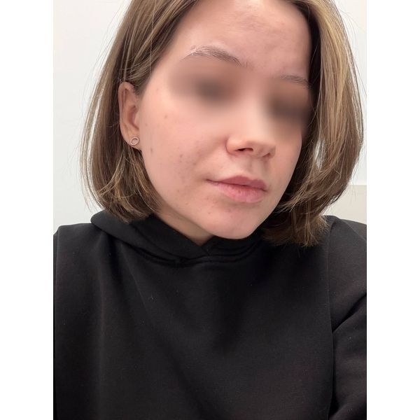 После лечения