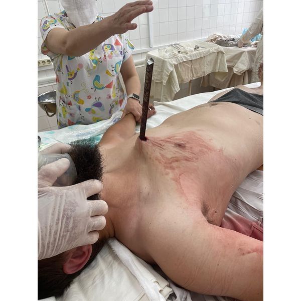 Сквозное ранение Сквозное ранение