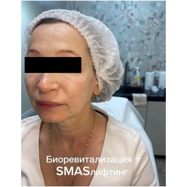 После второго этапа лечения После второго этапа лечения