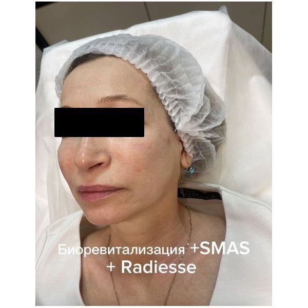 После третьего этапа лечения После третьего этапа лечения