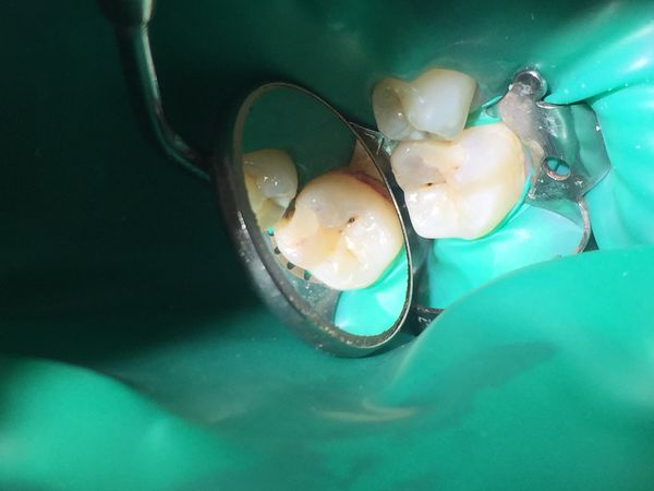 До лечения До лечения