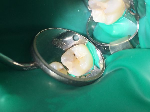 До лечения До лечения