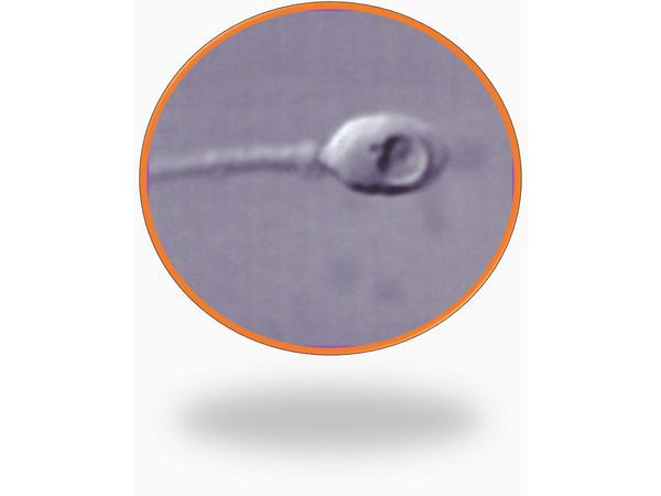 Исследование спермы