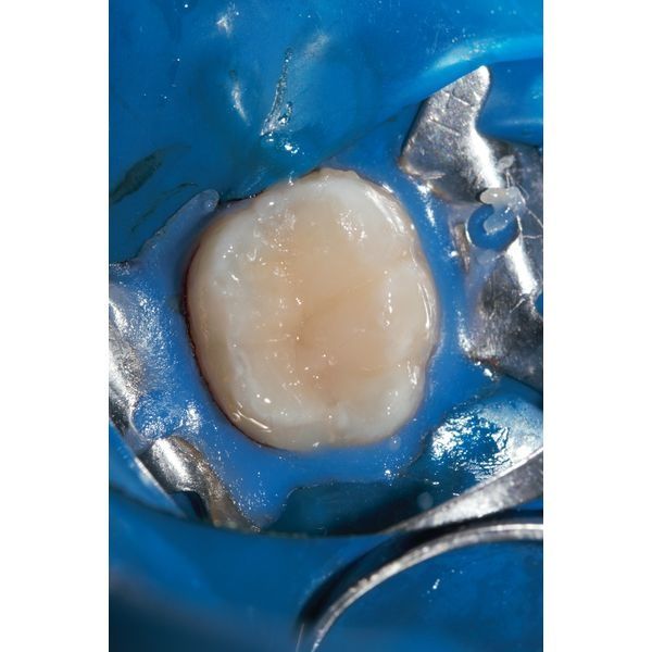 Установленная пломба