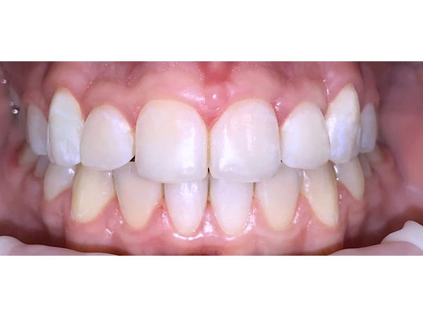 После лечения После лечения