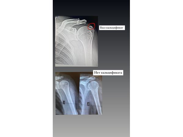 Результат операции Результат операции