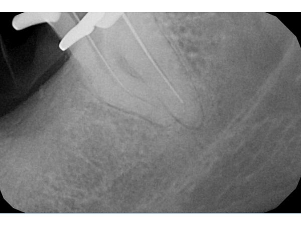 Обследование каналов Обследование каналов
