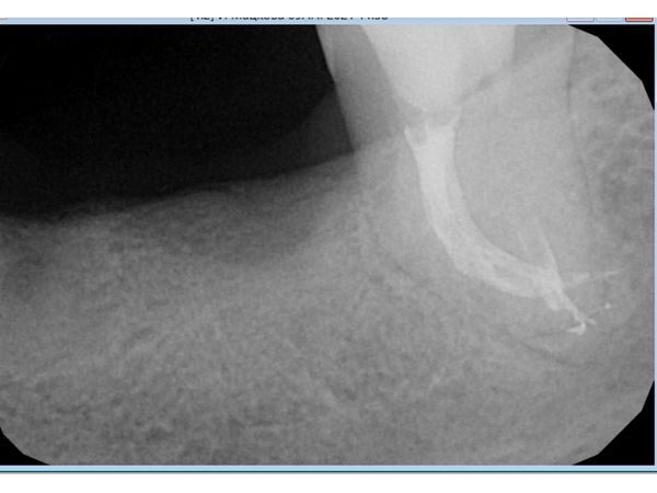 Результат лечения Результат лечения